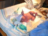 0903GraceBirth (24)